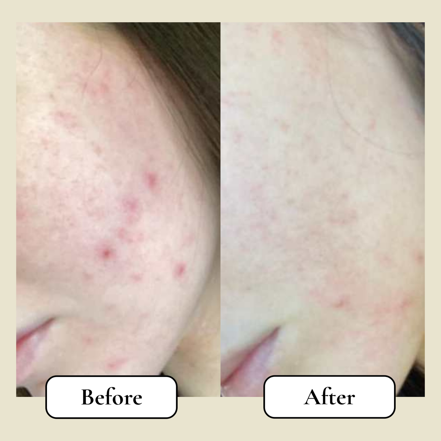 Belano's Barrier Reconstruction Tallow Balm