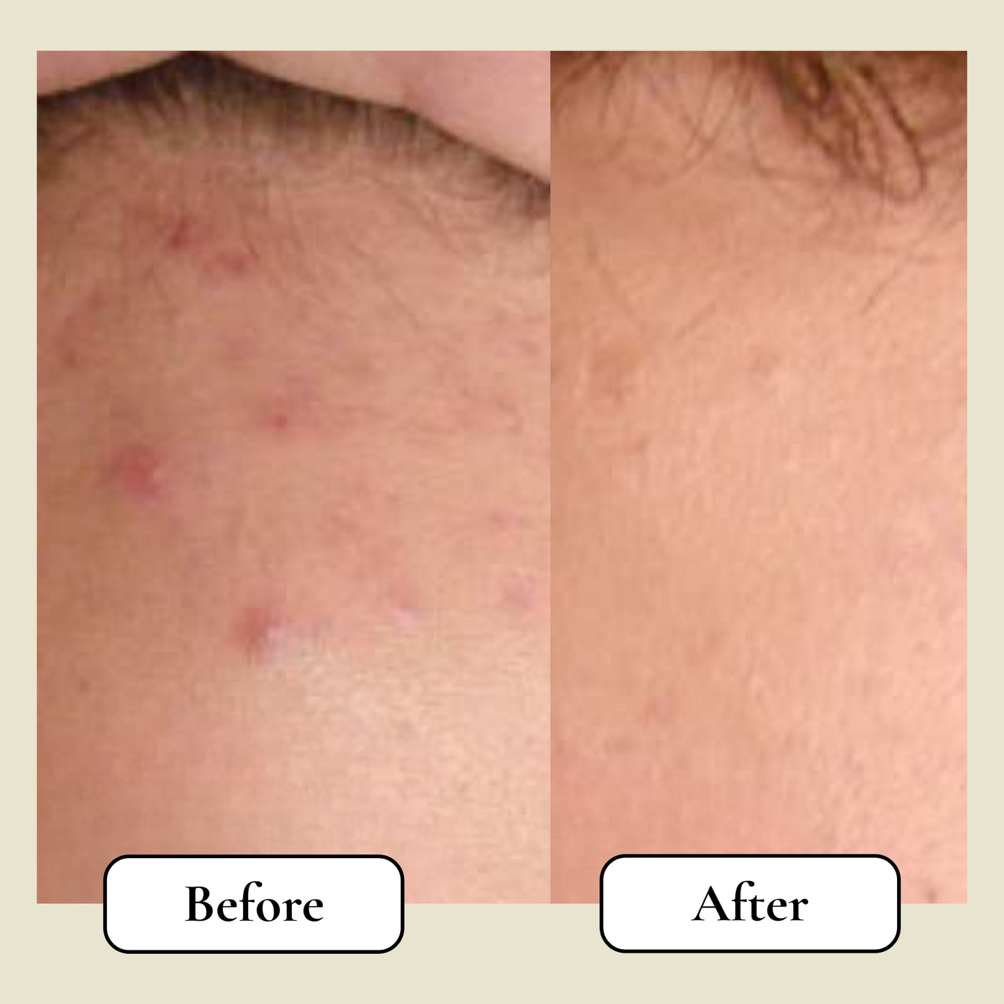 Belano's Barrier Reconstruction Tallow Balm