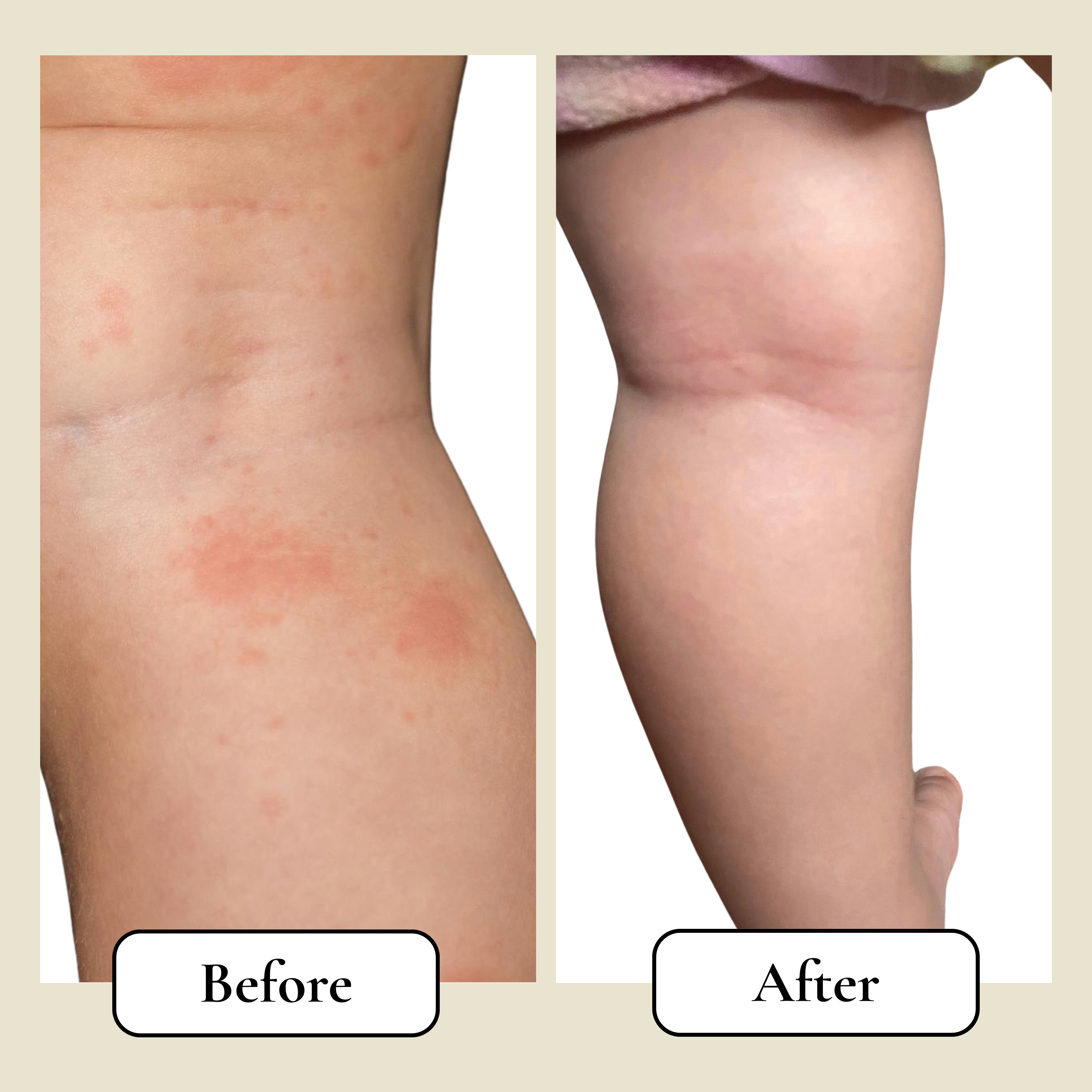 Liam Bath Water Filter